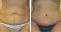 Before & After Photos
